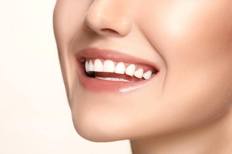 Teeth Whitening Brisbane Close Up Smile