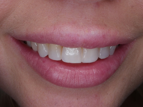 daniela mouth profile front