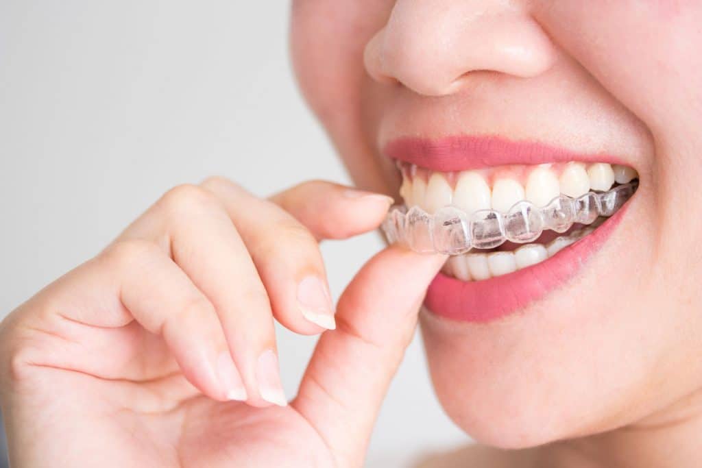 Smiling Woman Holding Invisalign Clear Aligners